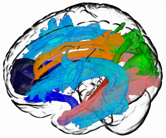 computer-generated image of brain with color tracks running through it