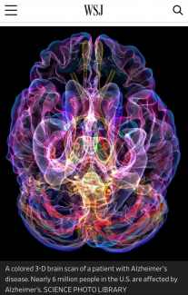 colorful 3-d image of the brain