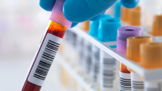 A photo of a gloved hand holding a vial of blood in front of set of other similar vials